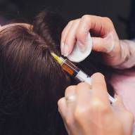 PRP tretman za rast kose